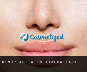 Rinoplastia em Itacoatiara Rinoplastia em Itacoatiara