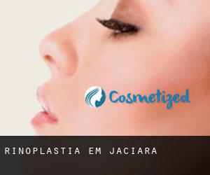 Rinoplastia em Jaciara