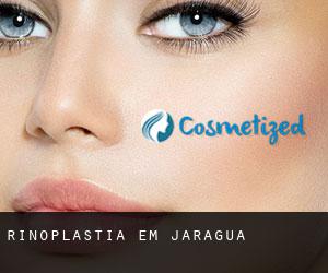 Rinoplastia em Jaraguá Rinoplastia em Jaraguá