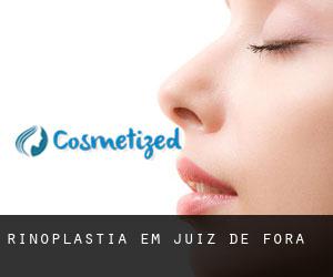 Rinoplastia em Juiz de Fora Rinoplastia em Juiz de Fora