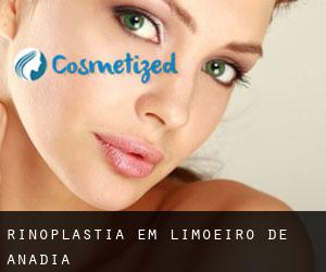 Rinoplastia em Limoeiro de Anadia Rinoplastia em Limoeiro de Anadia