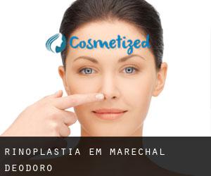 Rinoplastia em Marechal Deodoro Rinoplastia em Marechal Deodoro