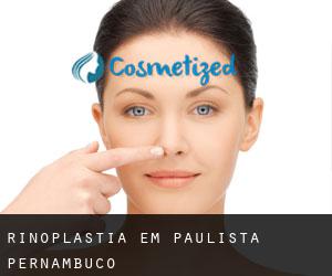 Rinoplastia em Paulista (Pernambuco) Rinoplastia em Paulista (Pernambuco)