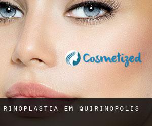 Rinoplastia em Quirinópolis Rinoplastia em Quirinópolis