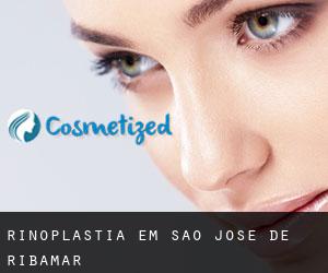 Rinoplastia em São José de Ribamar Rinoplastia em São José de Ribamar