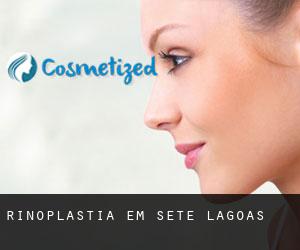 Rinoplastia em Sete Lagoas Rinoplastia em Sete Lagoas