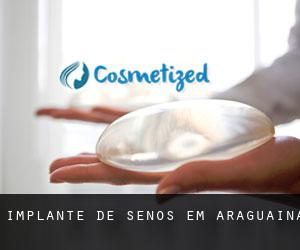 Implante de Senos em Araguaína