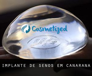 Implante de Senos em Canarana
