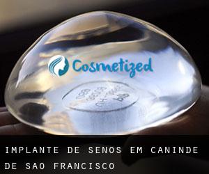 Implante de Senos em Canindé de São Francisco