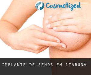 Implante de Senos em Itabuna Implante de Senos em Itabuna