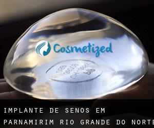 Implante de Senos em Parnamirim (Rio Grande do Norte)