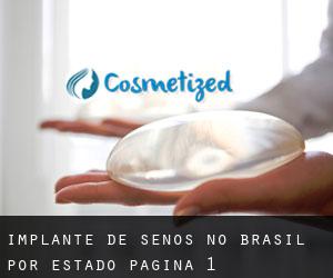 Implante de Senos no Brasil por Estado - página 1