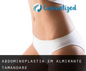 Abdominoplastia em Almirante Tamandaré Abdominoplastia em Almirante Tamandaré