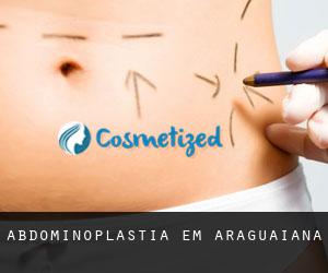 Abdominoplastia em Araguaiana