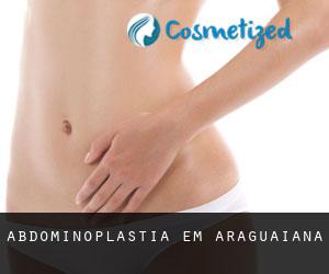 Abdominoplastia em Araguaiana