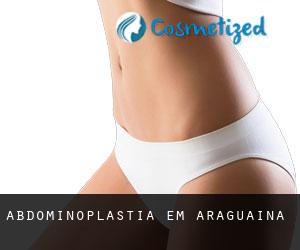 Abdominoplastia em Araguaína