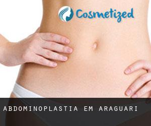 Abdominoplastia em Araguari