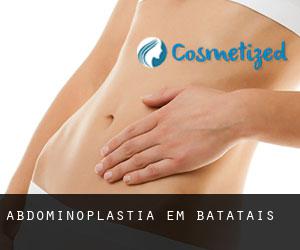 Abdominoplastia em Batatais