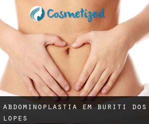 Abdominoplastia em Buriti dos Lopes