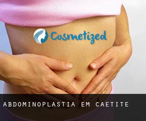Abdominoplastia em Caetité