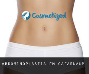 Abdominoplastia em Cafarnaum