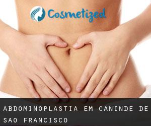 Abdominoplastia em Canindé de São Francisco
