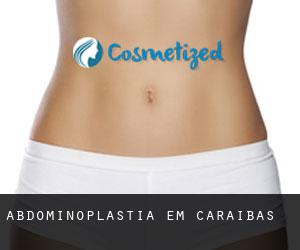 Abdominoplastia em Caraíbas Abdominoplastia em Caraíbas