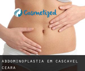 Abdominoplastia em Cascavel (Ceará)