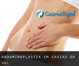 Abdominoplastia em Caxias do Sul Abdominoplastia em Caxias do Sul