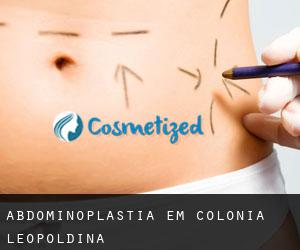 Abdominoplastia em Colônia Leopoldina