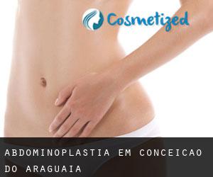 Abdominoplastia em Conceição do Araguaia