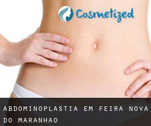 Abdominoplastia em Feira Nova do Maranhão