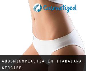 Abdominoplastia em Itabaiana (Sergipe)