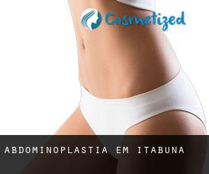 Abdominoplastia em Itabuna