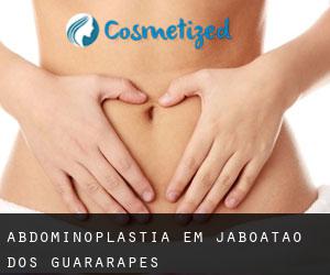 Abdominoplastia em Jaboatão dos Guararapes
