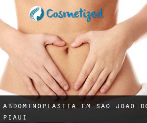 Abdominoplastia em São João do Piauí