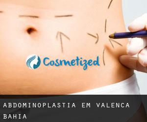 Abdominoplastia em Valença (Bahia) Abdominoplastia em Valença (Bahia)