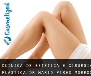 Clínica de Estética e Cirurgia Plástica Dr Mário Pires (Morros) #6